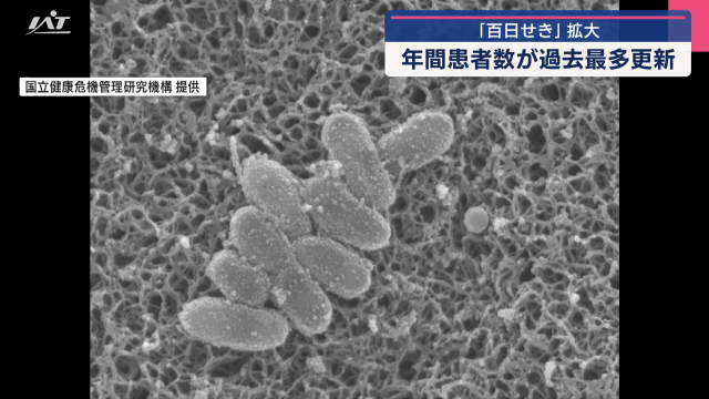 「百日せき」拡大　年間患者数が過去最多更新【岩手】